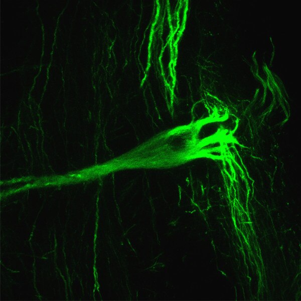 Immunofluorescent image of a Mauthner cell from a Xenopus laevis frog labeled with DSHB antibody 3A10 against neurofilament-associated protein, Mauthner cells. Image Credit: Karen Thompson, U of Iowa